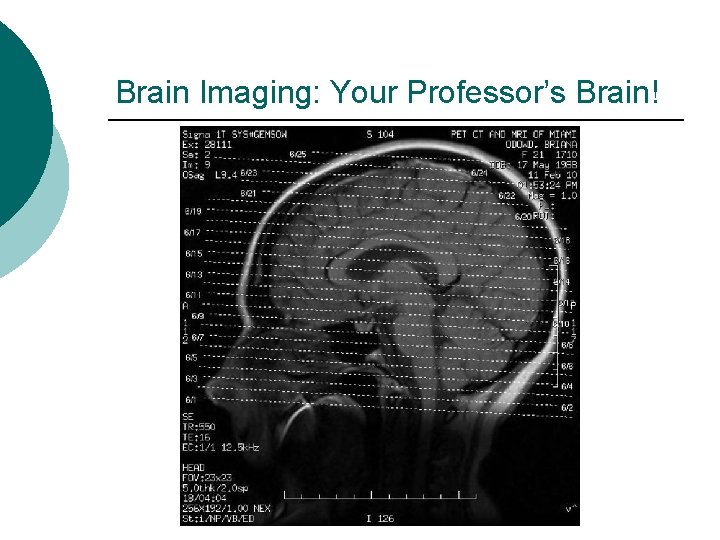 Brain Imaging: Your Professor’s Brain! 