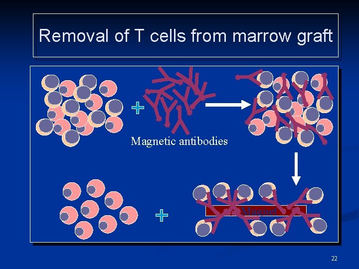 Removal of T cells from marrow graft Magnetic antibodies Magnet 22 
