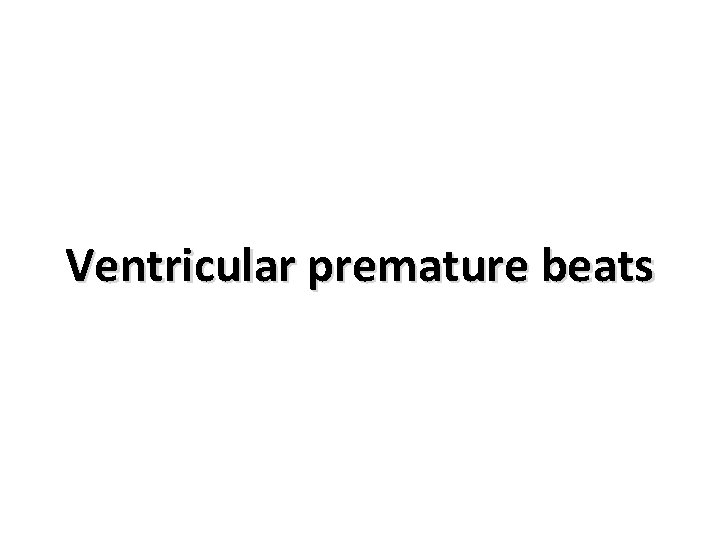 Ventricular premature beats 
