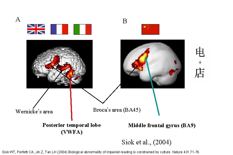 A B Wernicke’s area Broca’s area (BA 45) Posterior temporal lobe (VWFA) Middle frontal