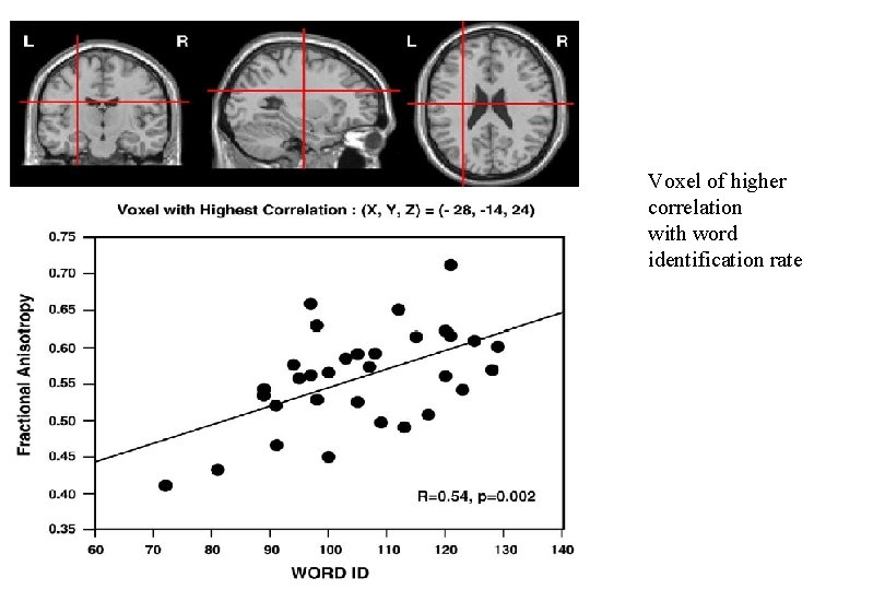 Voxel of higher correlation with word identification rate 