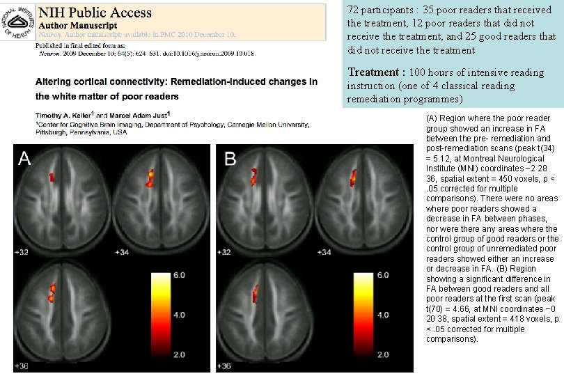 72 participants : 35 poor readers that received the treatment, 12 poor readers that