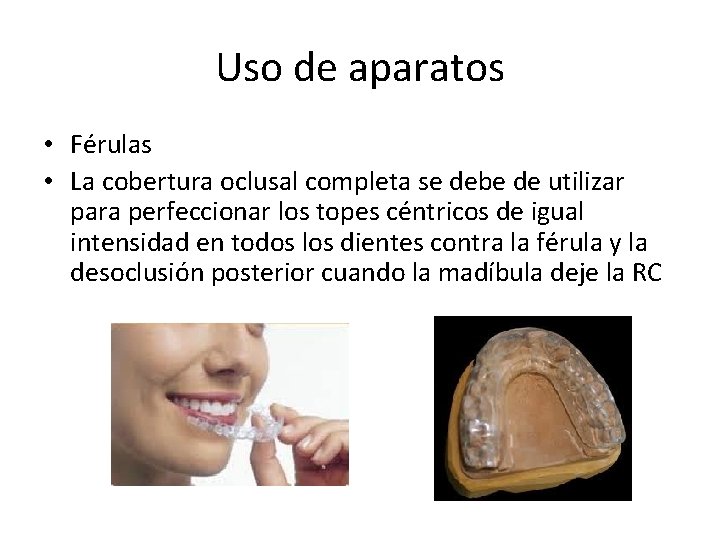 Uso de aparatos • Férulas • La cobertura oclusal completa se debe de utilizar