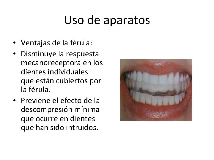 Uso de aparatos • Ventajas de la férula: • Disminuye la respuesta mecanoreceptora en