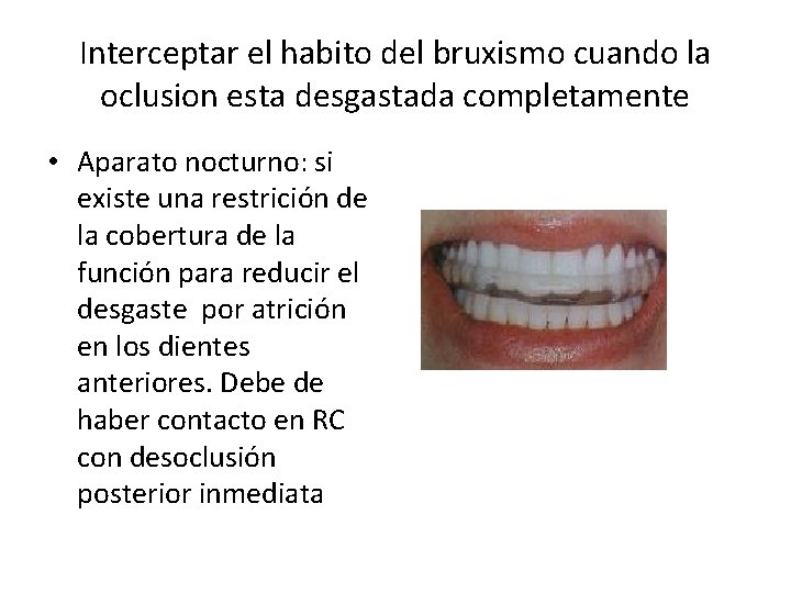 Interceptar el habito del bruxismo cuando la oclusion esta desgastada completamente • Aparato nocturno: