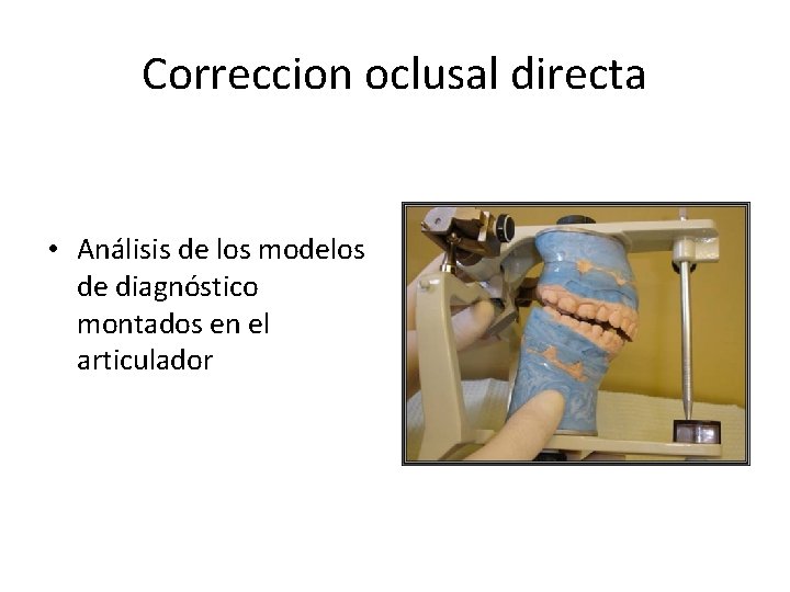 Correccion oclusal directa • Análisis de los modelos de diagnóstico montados en el articulador