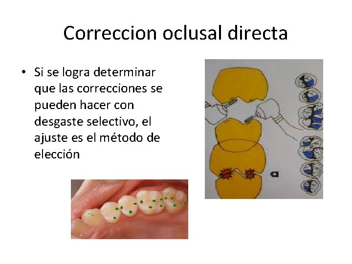 Correccion oclusal directa • Si se logra determinar que las correcciones se pueden hacer