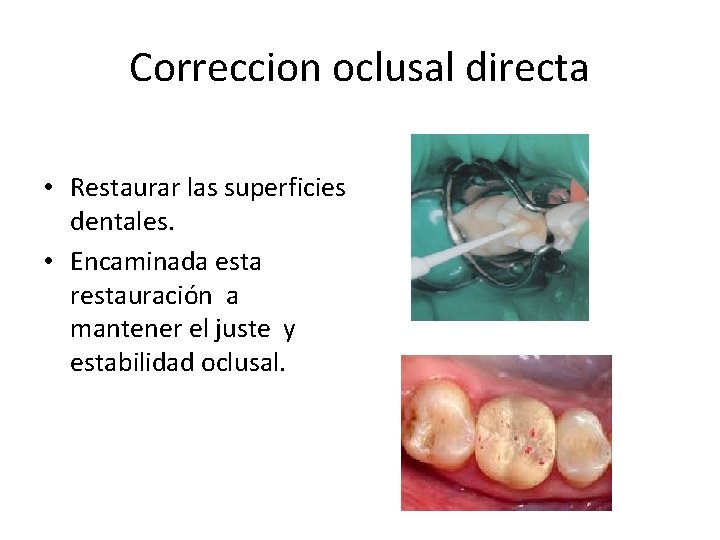 Correccion oclusal directa • Restaurar las superficies dentales. • Encaminada esta restauración a mantener