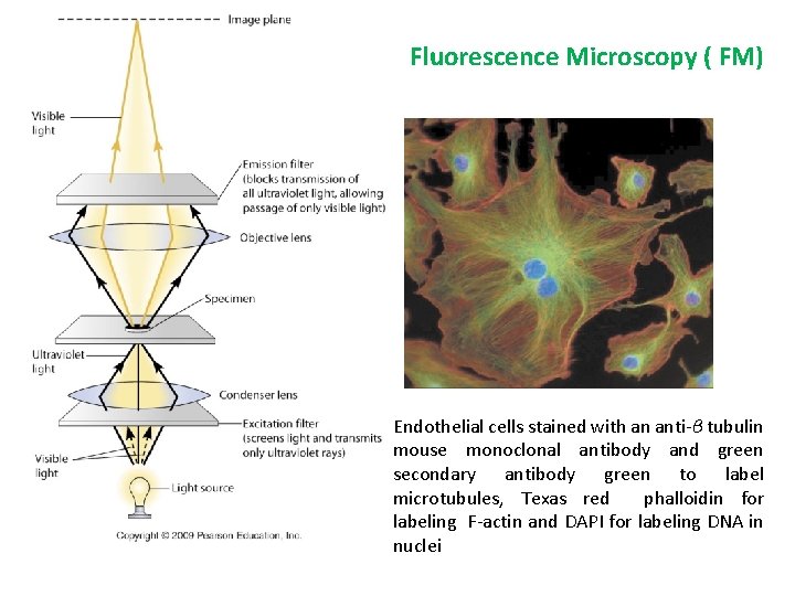 Fluorescence Microscopy ( FM) Endothelial cells stained with an anti-β tubulin mouse monoclonal antibody