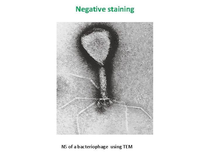 Negative staining NS of a bacteriophage using TEM 