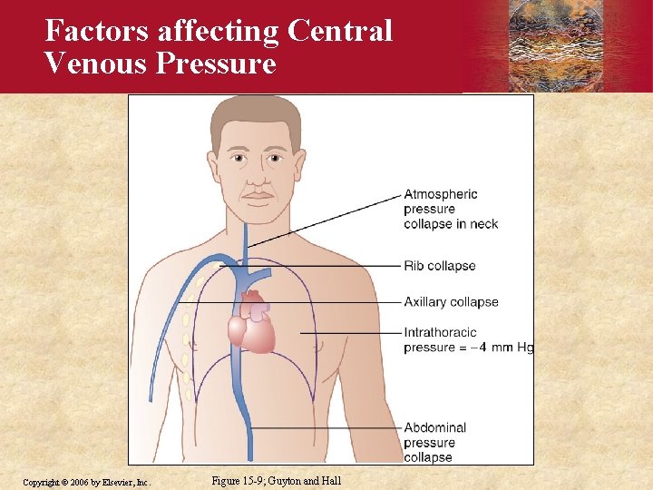 Factors affecting Central Venous Pressure Copyright © 2006 by Elsevier, Inc. Figure 15 -9;