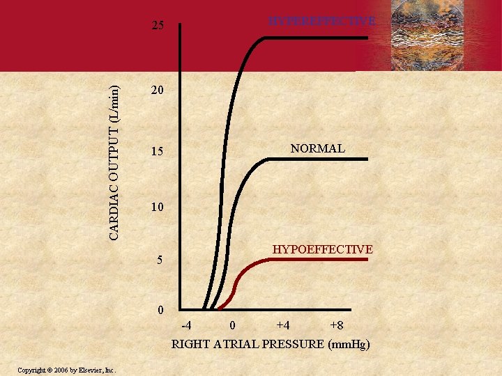 CARDIAC OUTPUT (L/min) 25 HYPEREFFECTIVE 20 15 NORMAL 10 5 HYPOEFFECTIVE 0 -4 0