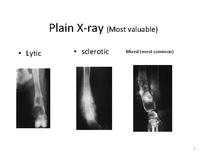 Plain X-ray (Most valuable) • Lytic • sclerotic Mixed (most common) 7 