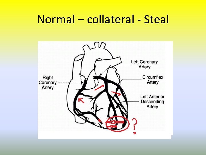 Normal – collateral - Steal 