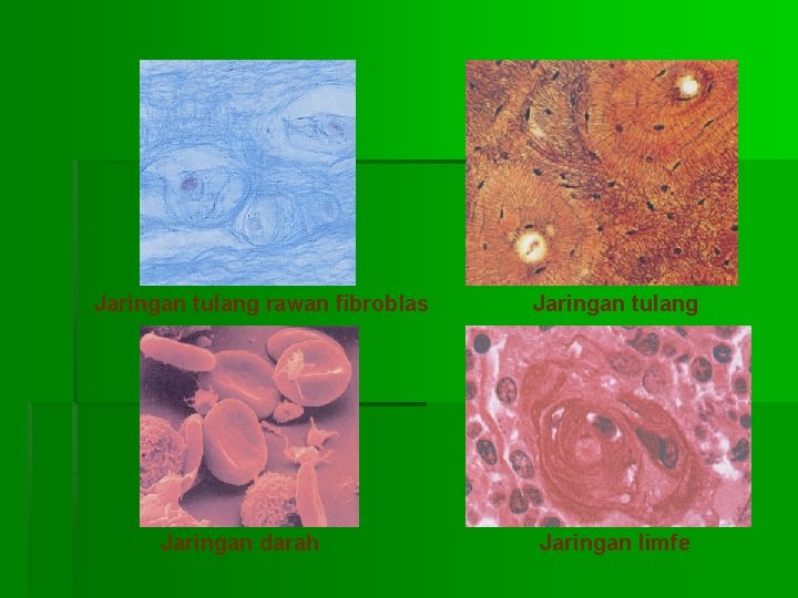 Jaringan tulang rawan fibroblas Jaringan darah Jaringan tulang Jaringan limfe 