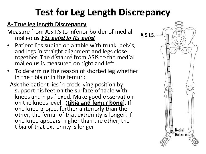 Test for Leg Length Discrepancy A- True leg length Discrepancy Measure from A. S.