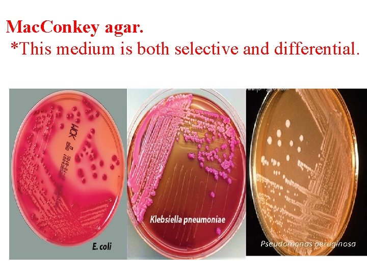 Mac. Conkey agar. *This medium is both selective and differential. Pseudomonas aeruginosa 