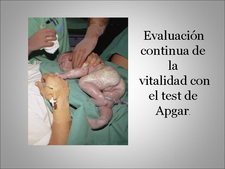 Evaluación continua de la vitalidad con el test de Apgar. 