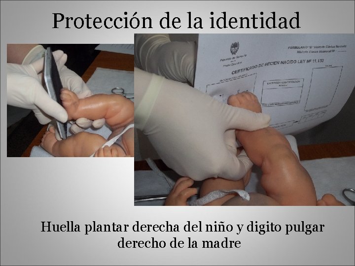 Protección de la identidad Huella plantar derecha del niño y digito pulgar derecho de