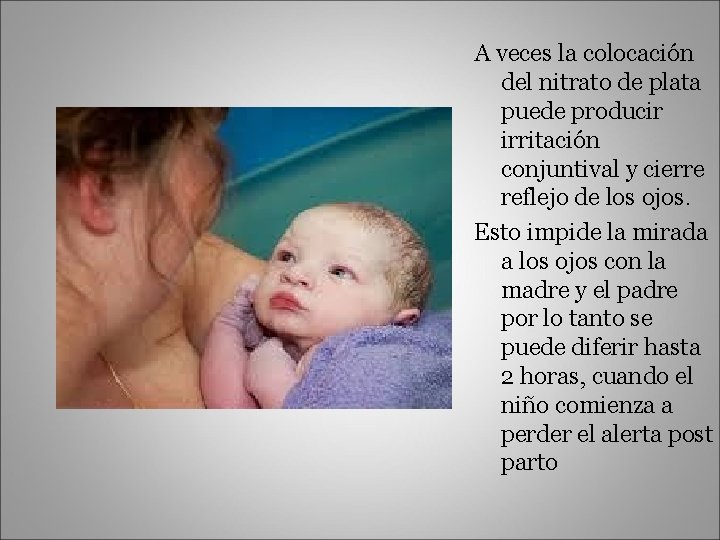 A veces la colocación del nitrato de plata puede producir irritación conjuntival y cierre