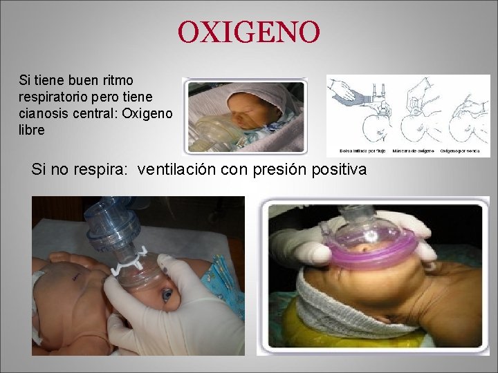 OXIGENO Si tiene buen ritmo respiratorio pero tiene cianosis central: Oxigeno libre Si no