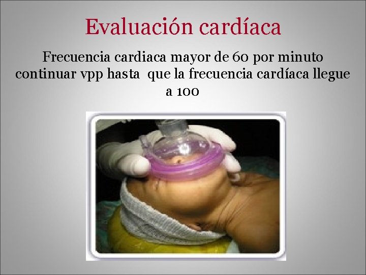 Evaluación cardíaca Frecuencia cardiaca mayor de 60 por minuto continuar vpp hasta que la