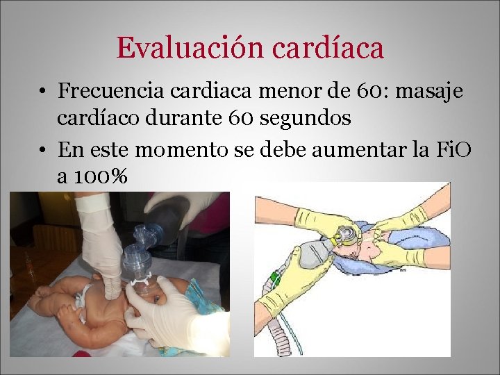 Evaluación cardíaca • Frecuencia cardiaca menor de 60: masaje cardíaco durante 60 segundos •