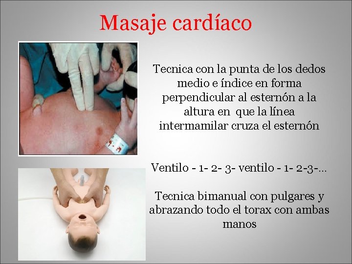 Masaje cardíaco Tecnica con la punta de los dedos medio e índice en forma