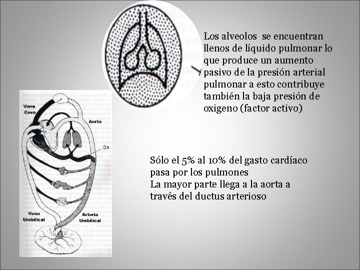 Los alveolos se encuentran llenos de líquido pulmonar lo que produce un aumento pasivo