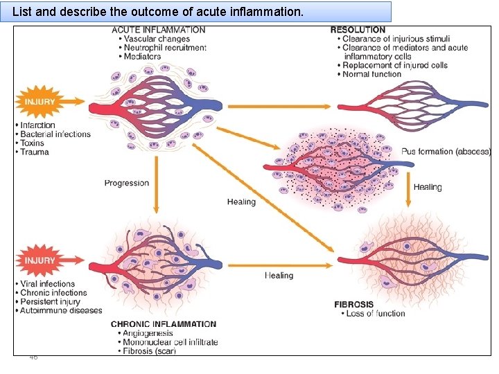 List and describe the outcome of acute inflammation. 46 