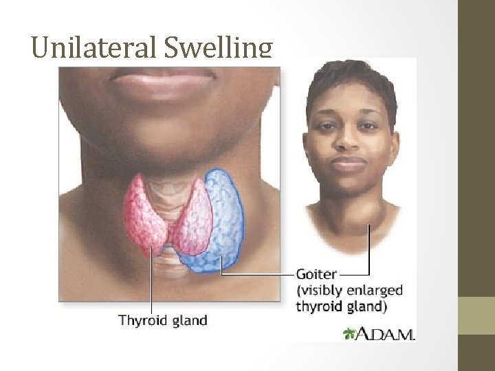 Unilateral Swelling 