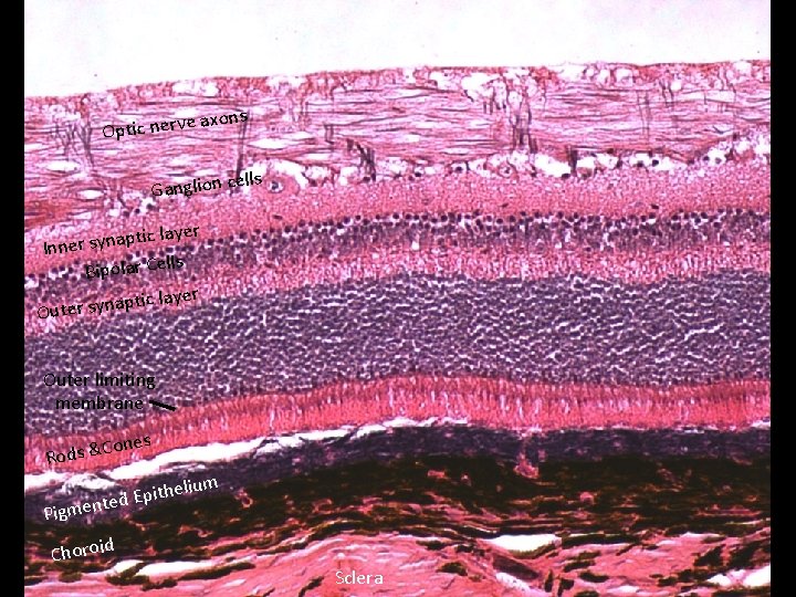 Histology of the Retina xons ea Optic nerv ells Ganglion c ic layer t