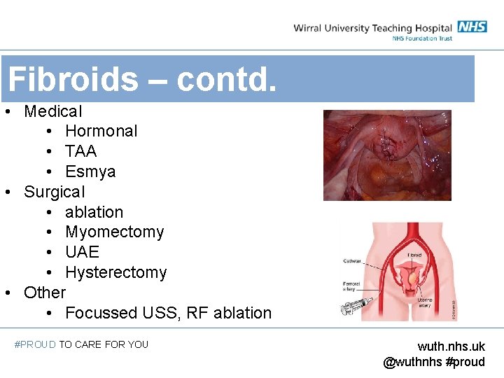 Fibroids – contd. • Medical • Hormonal • TAA • Esmya • Surgical •