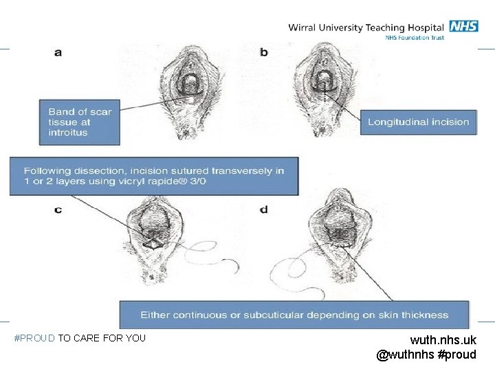 #PROUD TO CARE FOR YOU wuth. nhs. uk @wuthnhs #proud 