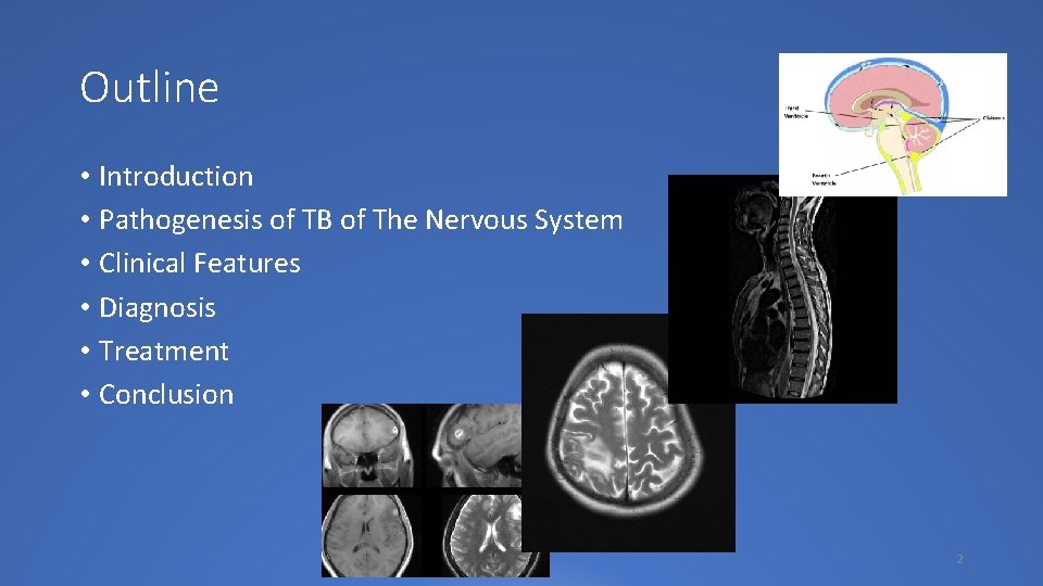 Outline • Introduction • Pathogenesis of TB of The Nervous System • Clinical Features