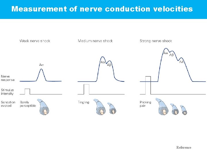 Measurement of nerve conduction velocities Reference 