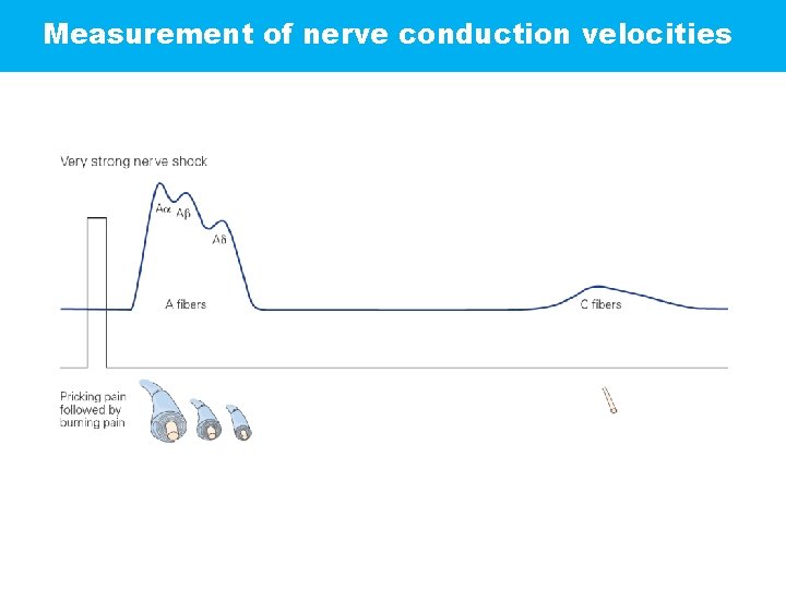 Measurement of nerve conduction velocities 