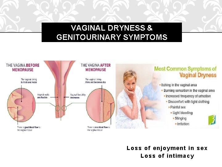 VAGINAL DRYNESS & GENITOURINARY SYMPTOMS Loss of enjoyment in sex Loss of intimacy 