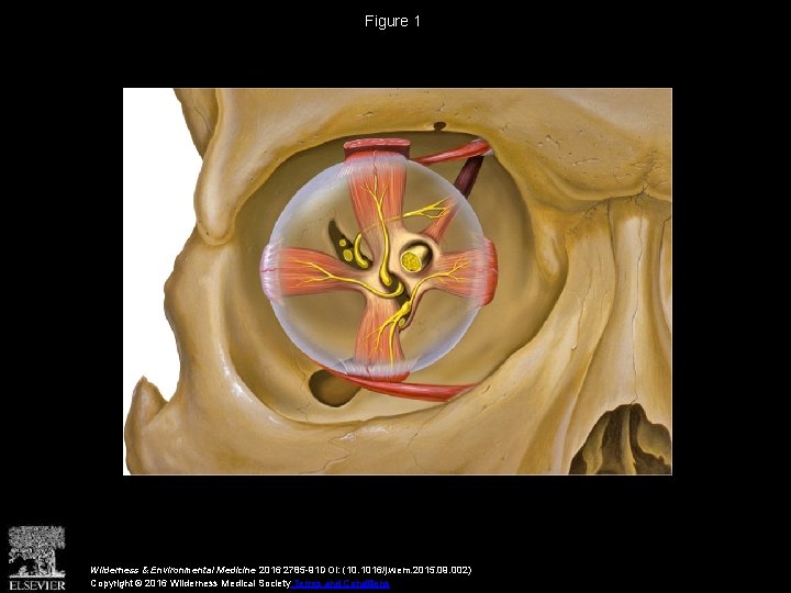 Figure 1 Wilderness & Environmental Medicine 2016 2785 -91 DOI: (10. 1016/j. wem. 2015.