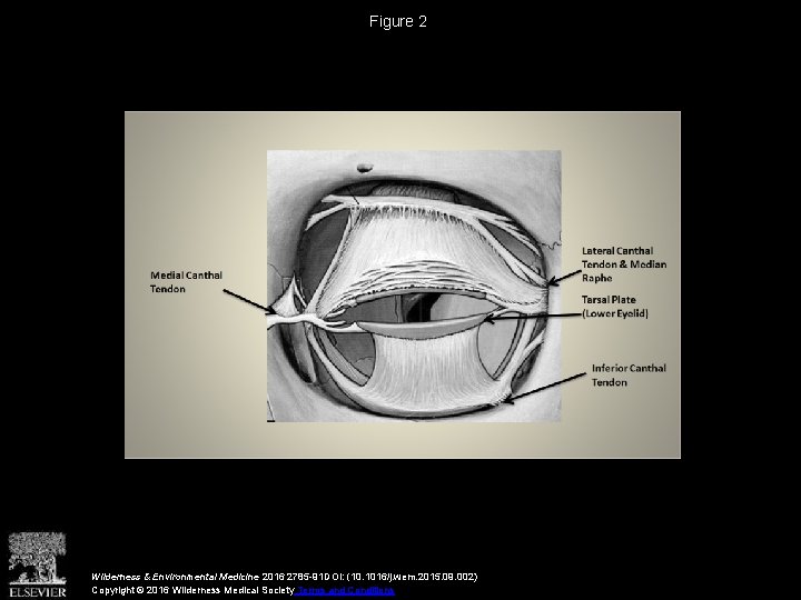Figure 2 Wilderness & Environmental Medicine 2016 2785 -91 DOI: (10. 1016/j. wem. 2015.