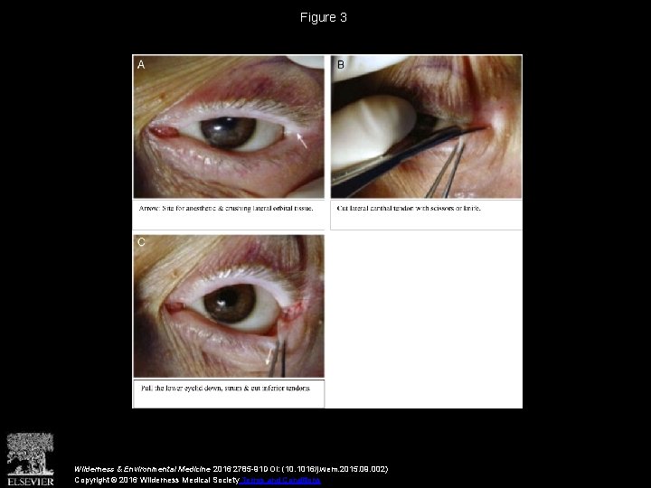 Figure 3 Wilderness & Environmental Medicine 2016 2785 -91 DOI: (10. 1016/j. wem. 2015.