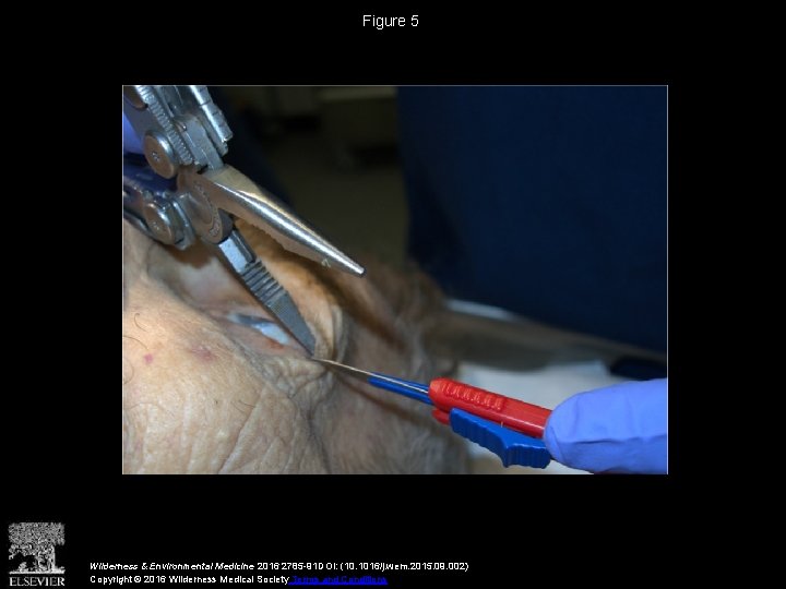 Figure 5 Wilderness & Environmental Medicine 2016 2785 -91 DOI: (10. 1016/j. wem. 2015.