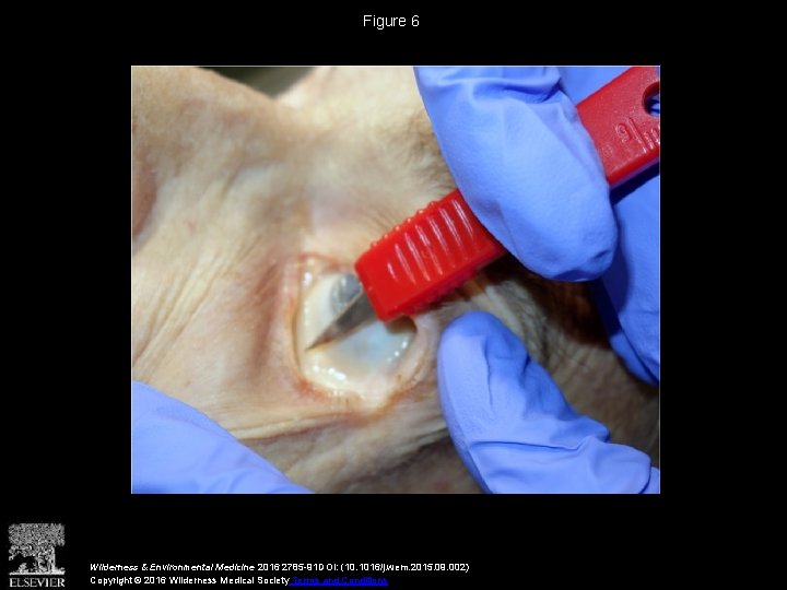 Figure 6 Wilderness & Environmental Medicine 2016 2785 -91 DOI: (10. 1016/j. wem. 2015.