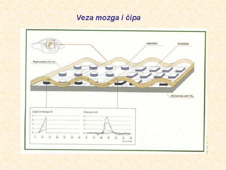 Veza mozga i čipa 