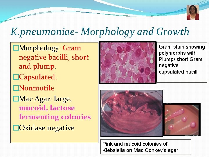 K. pneumoniae- Morphology and Growth �Morphology: Gram negative bacilli, short and plump. �Capsulated. �Nonmotile