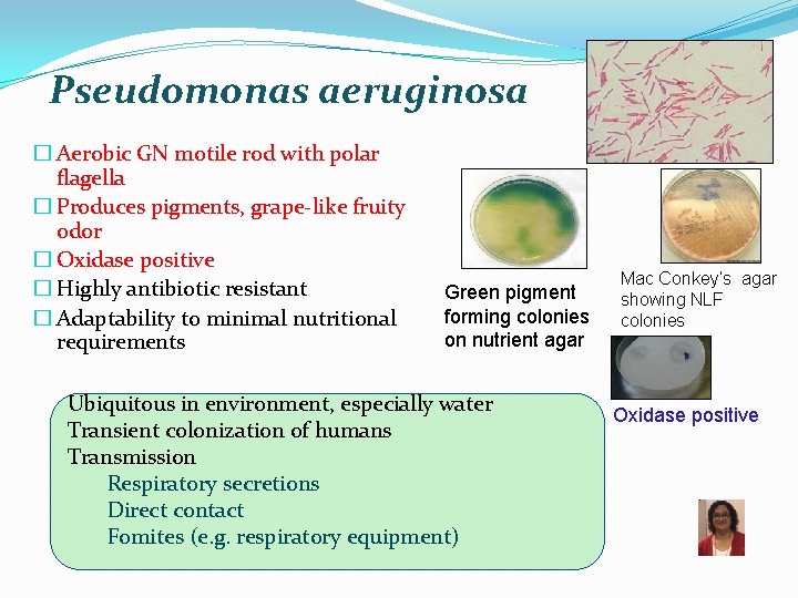 Pseudomonas aeruginosa � Aerobic GN motile rod with polar flagella � Produces pigments, grape-like
