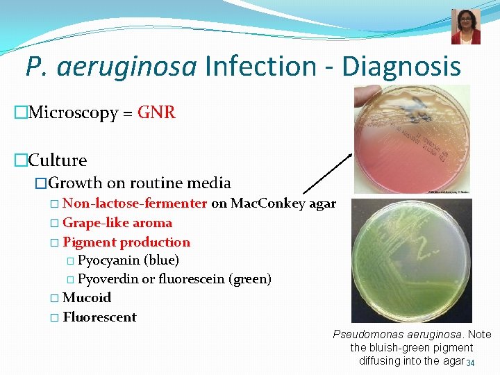 P. aeruginosa Infection - Diagnosis �Microscopy = GNR �Culture �Growth on routine media �