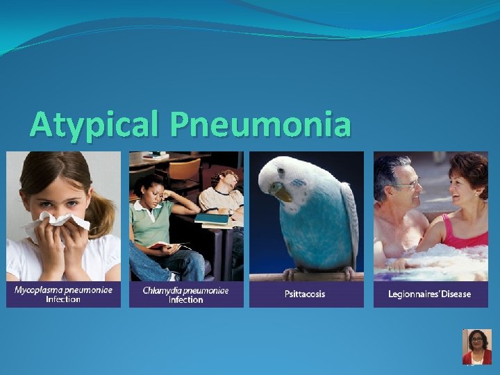 Atypical Pneumonia 76 