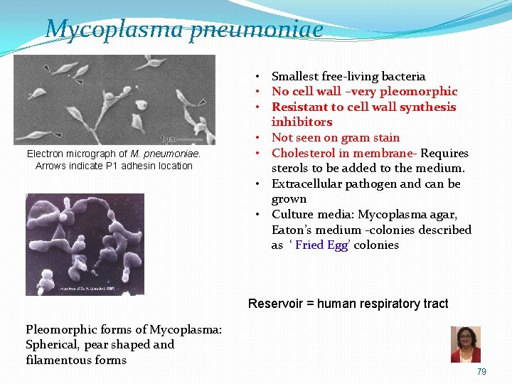 Mycoplasma pneumoniae Electron micrograph of M. pneumoniae. Arrows indicate P 1 adhesin location •