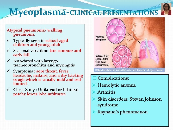 Mycoplasma-CLINICAL PRESENTATIONS Atypical pneumonia/ walking pneumonia ü Typically seen in school-aged children and young